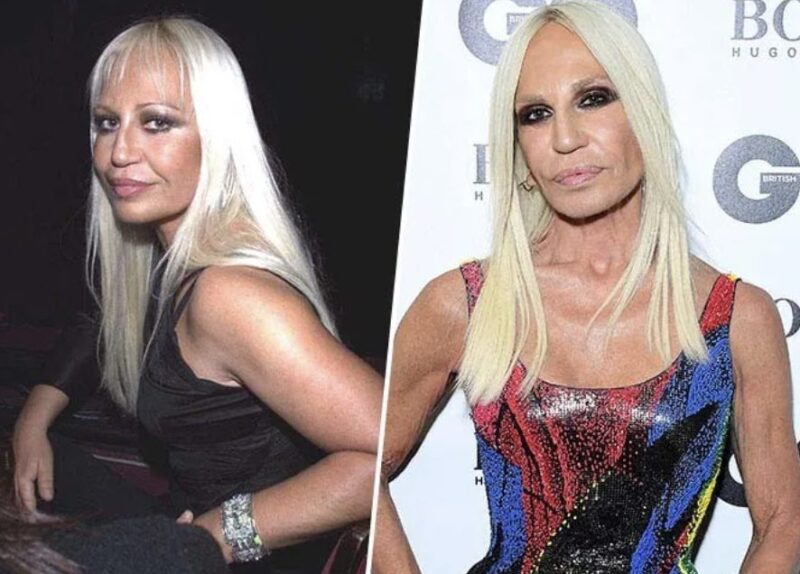 Brigitte Bardot, Donatella Versace, Mickey Rourke… queste celebrità che sono invecchiate molto male