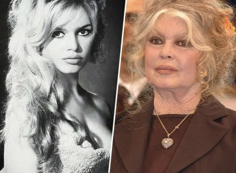 Brigitte Bardot, Donatella Versace, Mickey Rourke… queste celebrità che sono invecchiate molto male